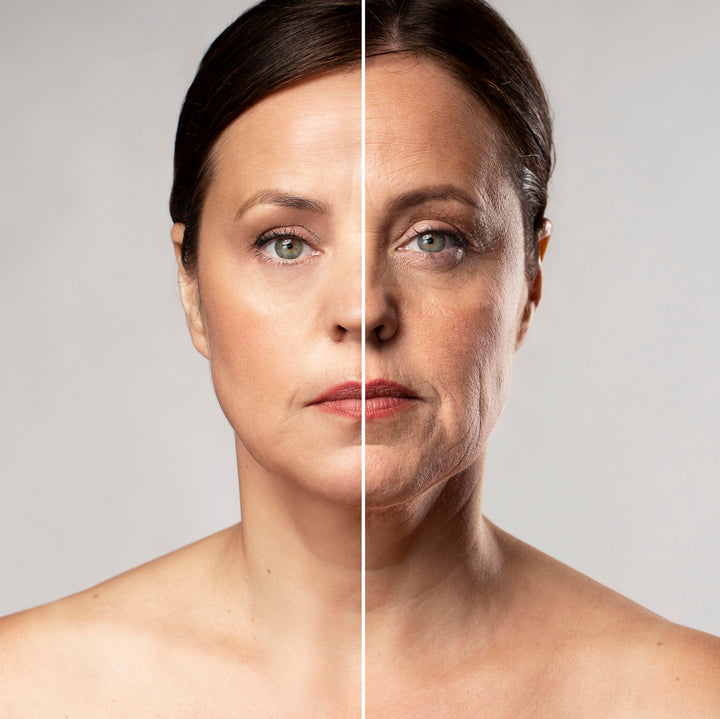 Injectables: Will Fillers Make Me Look Fake?