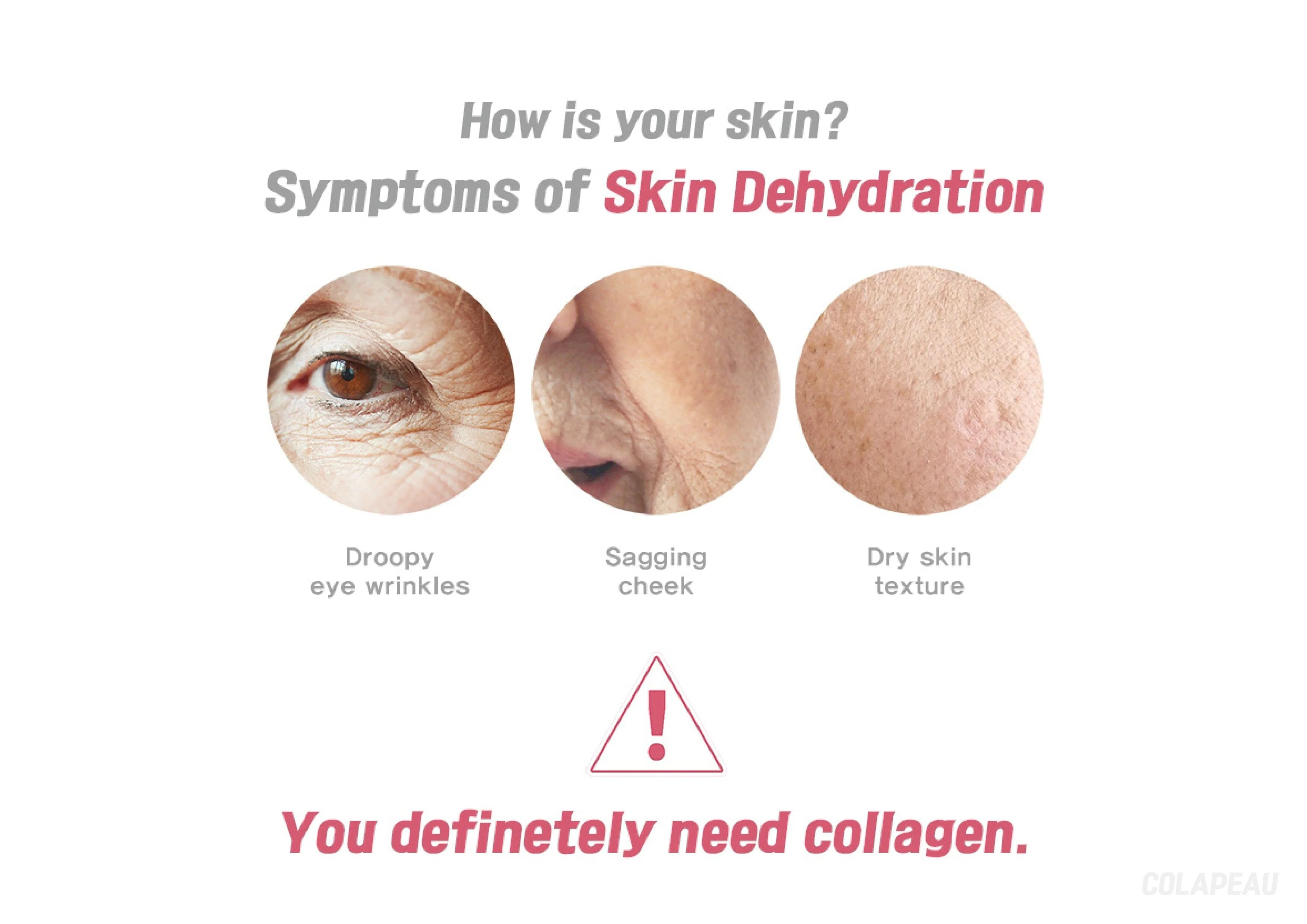 COLAPEAU info 3-rosvia.com